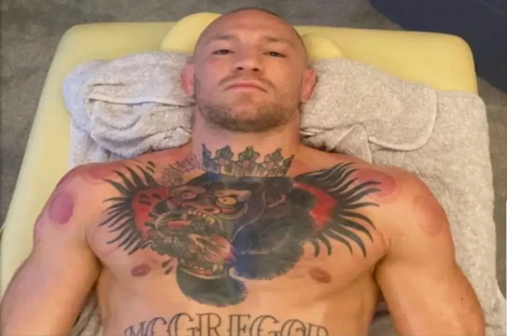 Conor McGregor Meninggal...