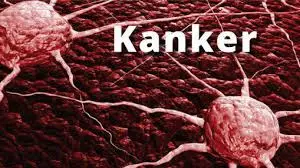 70 Persen Pasien Kanker...
