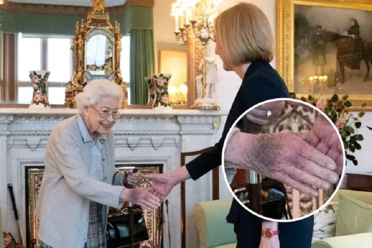 Tangan Memar Ratu Elizabeth...