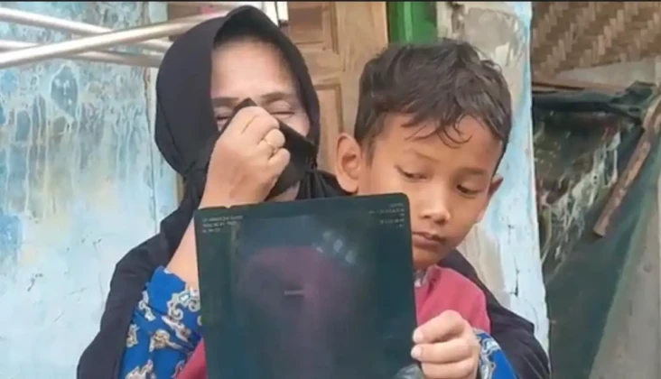 Heboh Bocah Telan Kunci...