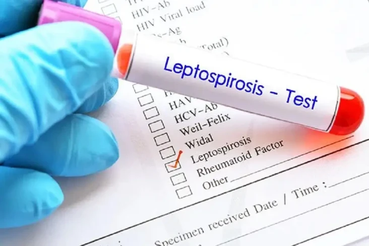 Mengenal Leptospirosis,...