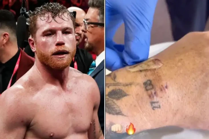 Saul Canelo Alvarez...