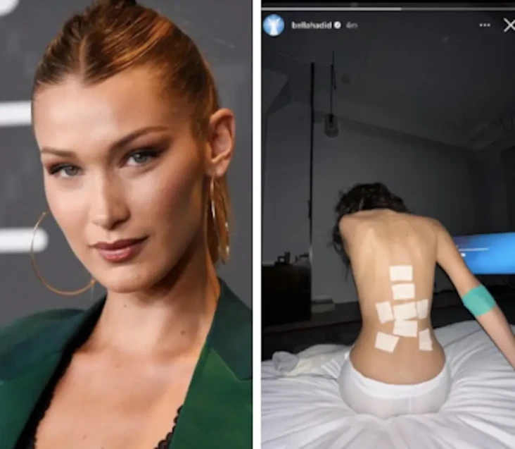 Viral! Foto Bella Hadid...