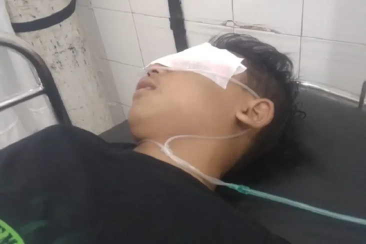 Sadis! Pelajar SMP di...