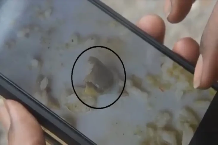 Kasus Potongan Jari...