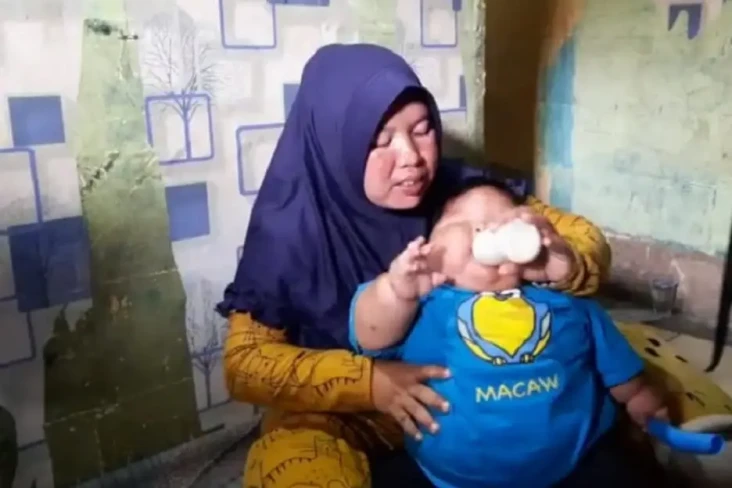 Bayi Obesitas di Bekasi...
