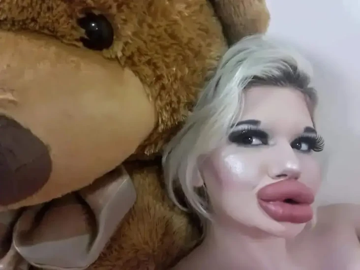 Pemilik Bibir Terbesar...