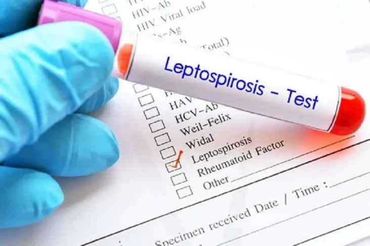 Hati-Hati, Leptospirosis...