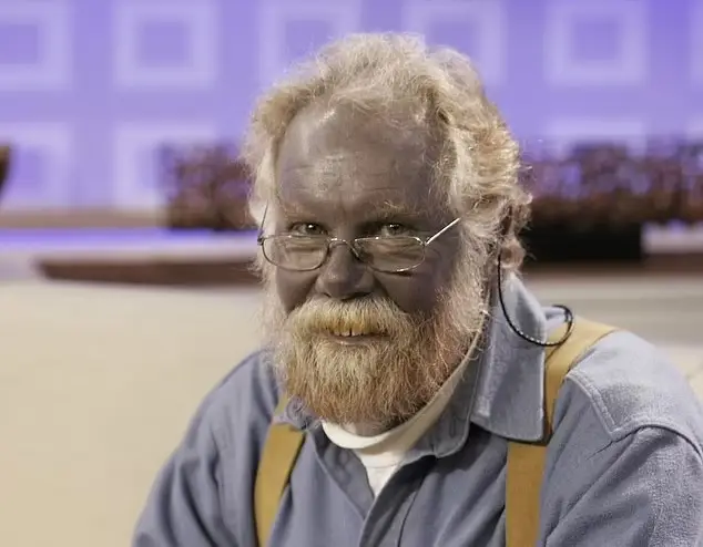 Papa Smurf Asli, Kulit...
