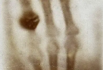 Tragedi Wilhelm Röntgen,...