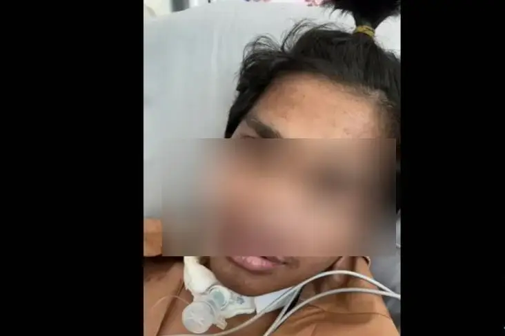 Jalani Perawatan di...