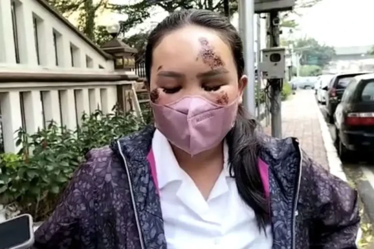 Laporkan Sang Kekasih...