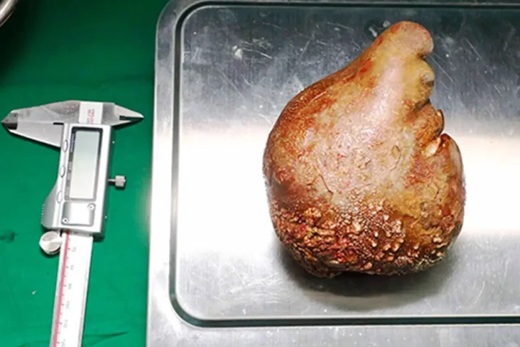 Dokter Sri Lanka Berhasil...