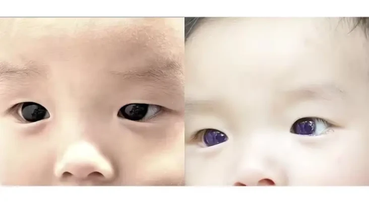 Warna Bola Mata Bayi...
