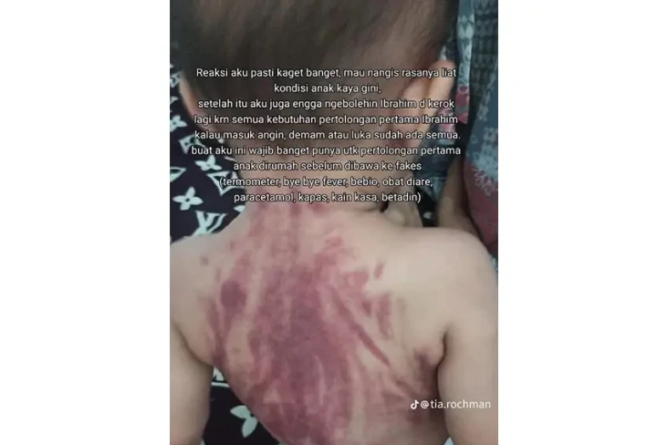 Viral! Anak 13 Bulan...