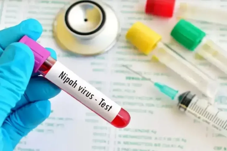 Virus Nipah Dapat Menular,...