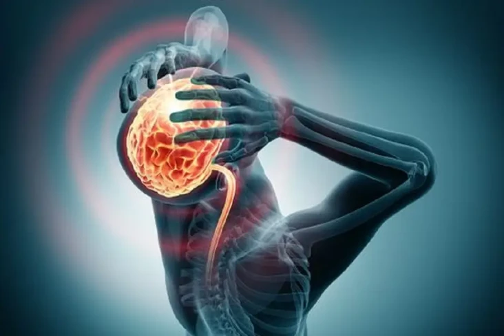 Benarkah Stroke Jadi...