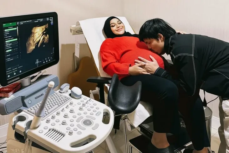 Aurel Hermansyah Melahirkan...