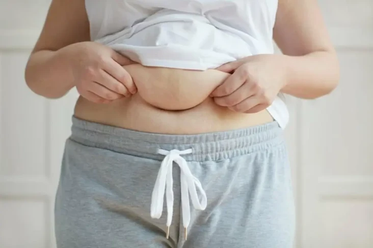 7 Cara Mengatasi Perut...