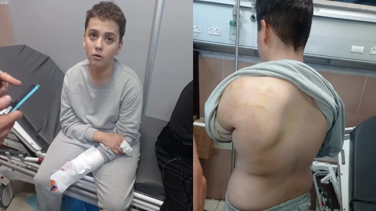 Liciknya Israel, Bebaskan...
