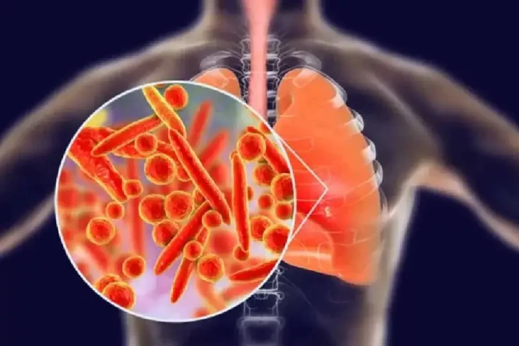 Virus Mycoplasma Merebak...