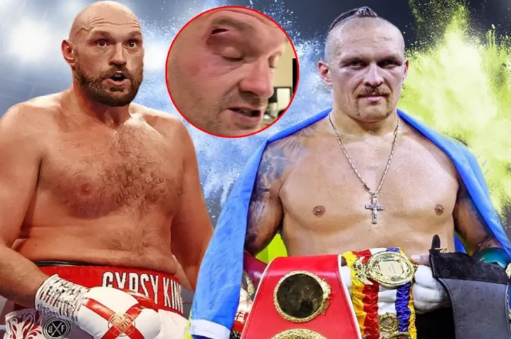 Tyson Fury Dapat 11...