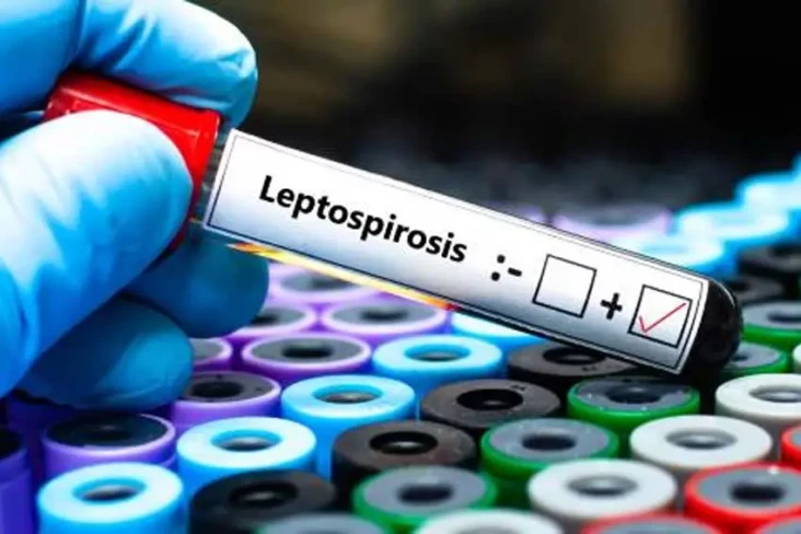 Waspada Penyakit Leptospirosis...