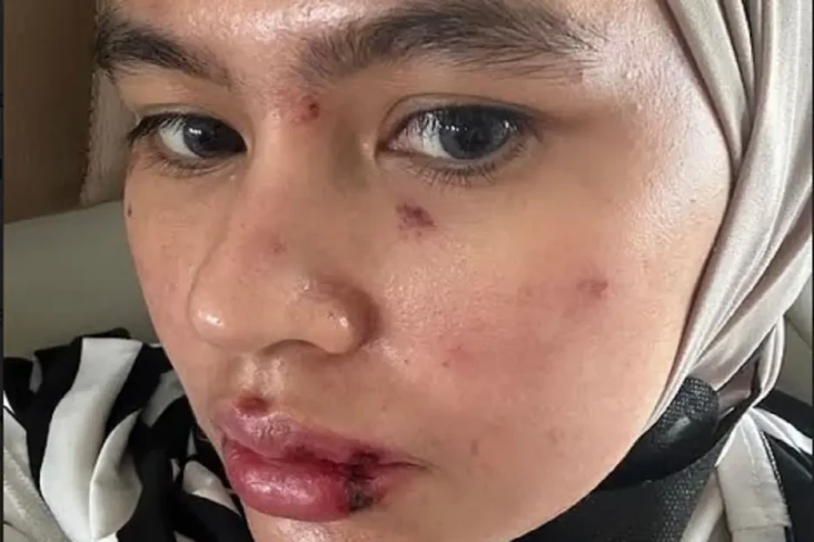 Kartika Putri Memperlihatkan...