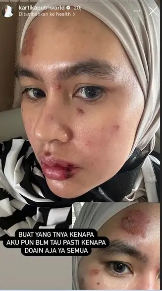 Kartika Putri Sedih...