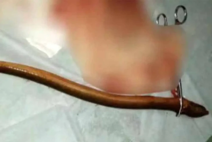 Dokter Berhasil Keluarkan...