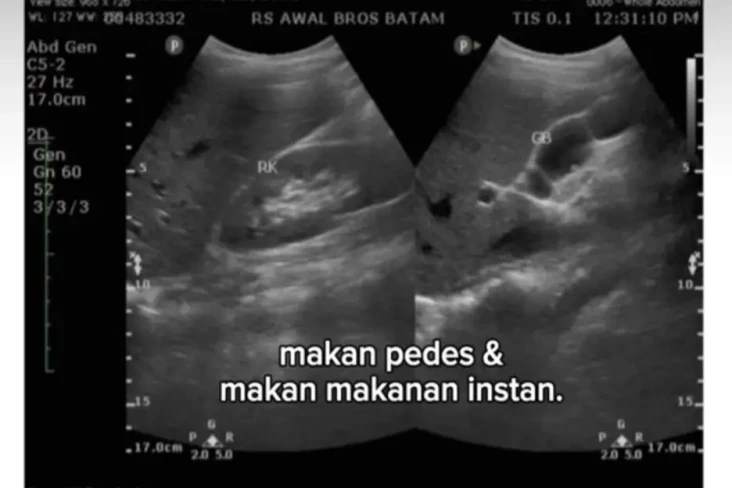 Kisah Pilu Wanita Idap...