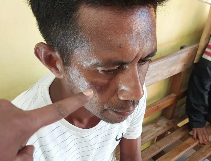 Pria di NTT Bikin Laporan...
