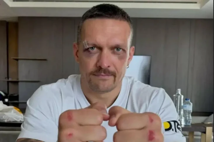Petinju Pukulan Terkeras...