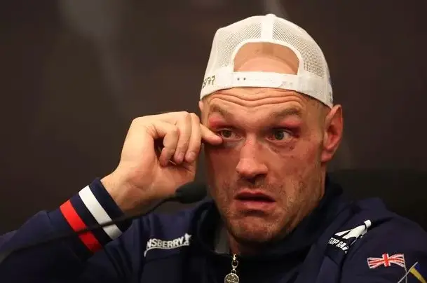 Kronologi Tyson Fury...