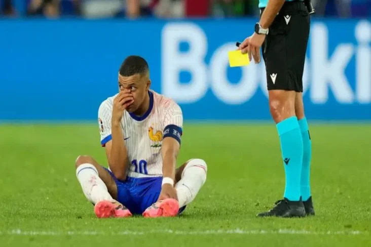 Hidung Kylian Mbappe...