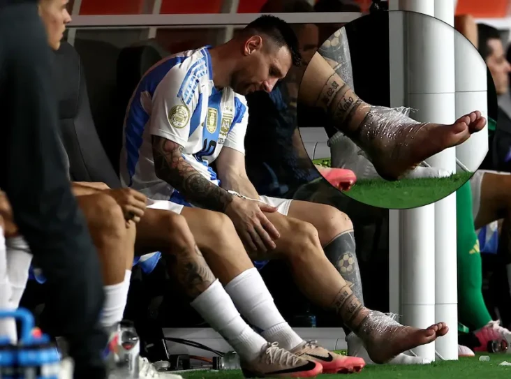 Kaki Lionel Messi Dibungkus...