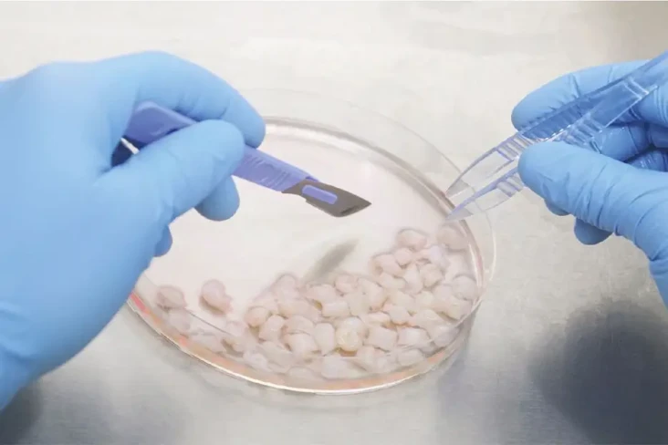 Stem Cell Mesenkimal...