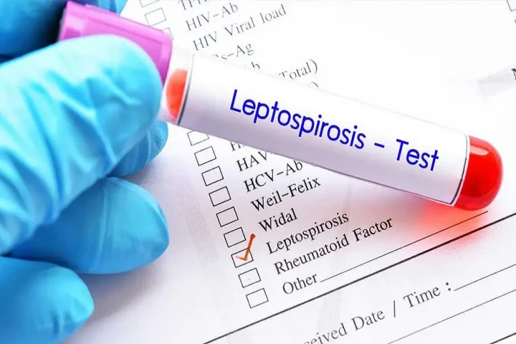 Mengenal Leptospirosis,...