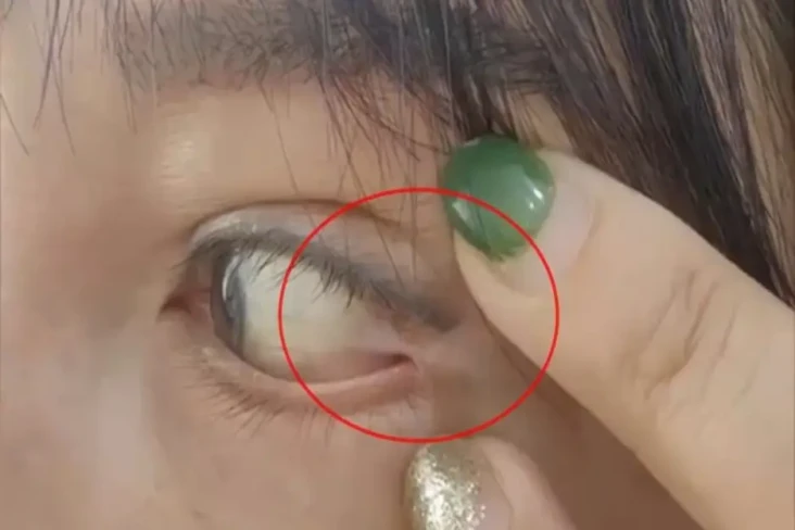 Ngeri! Bola Mata Wanita...