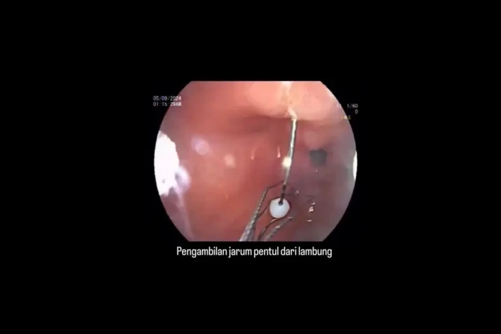 Viral Detik-detik Dokter...