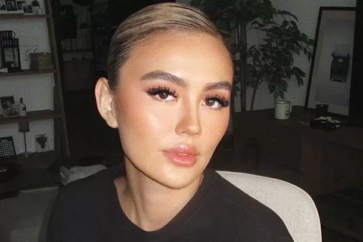 Mengenal Alopecia Areata,...