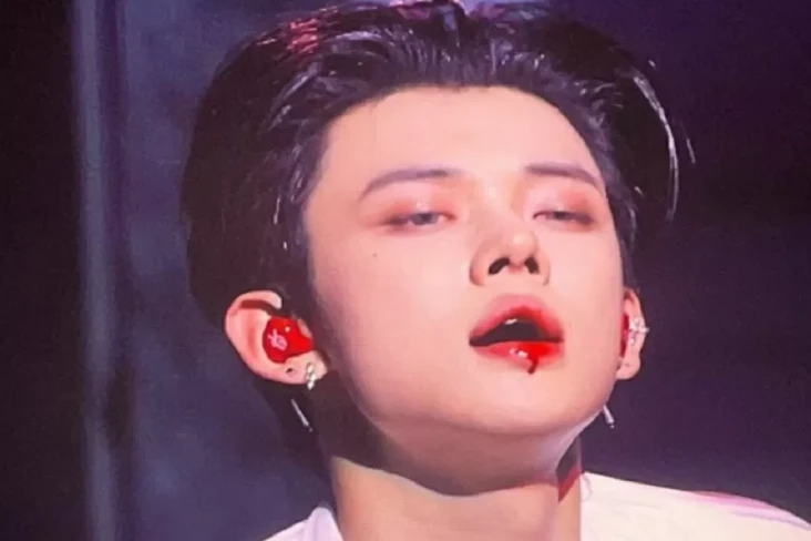 Yeonjun TXT Terluka...
