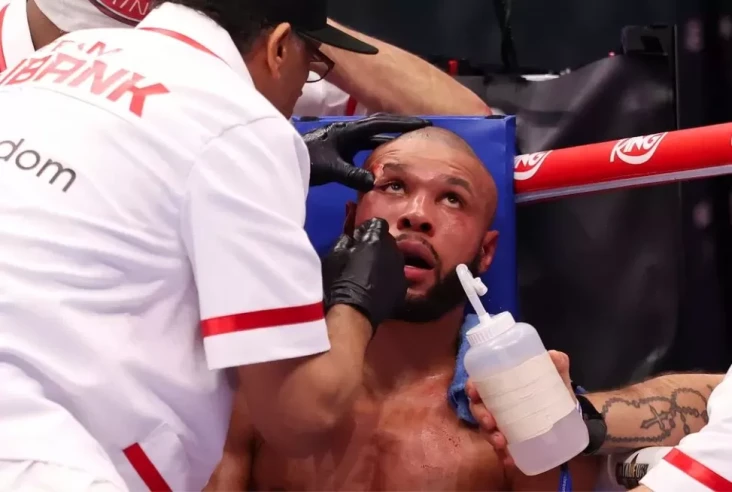 Conor Benn Ungkap Cedera...