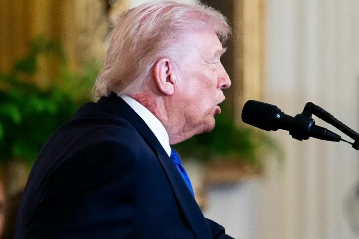 Ruam di Leher Trump...