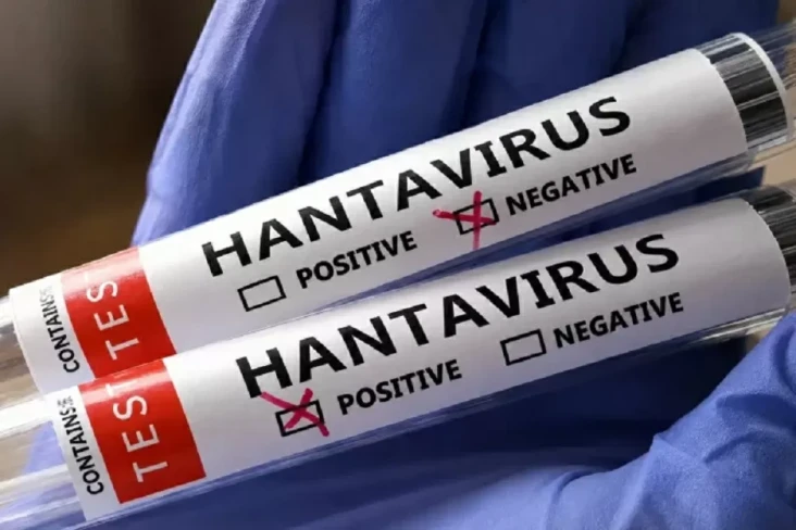 3 Kasus Positif Hantavirus...