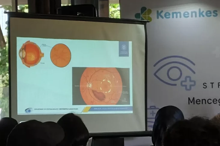 Penglihatan Kabur Belum...