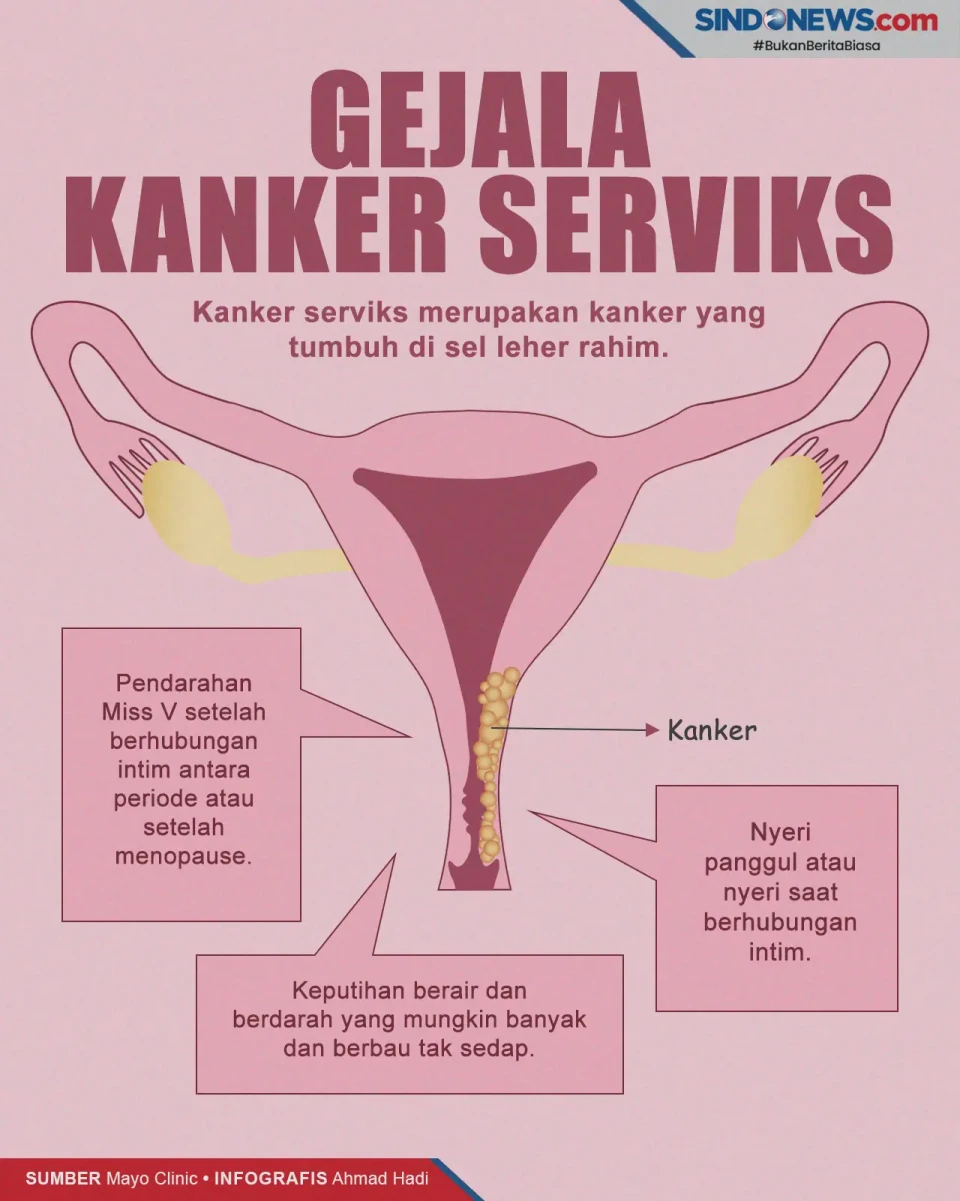 Perempuan Wajib Tahu,...