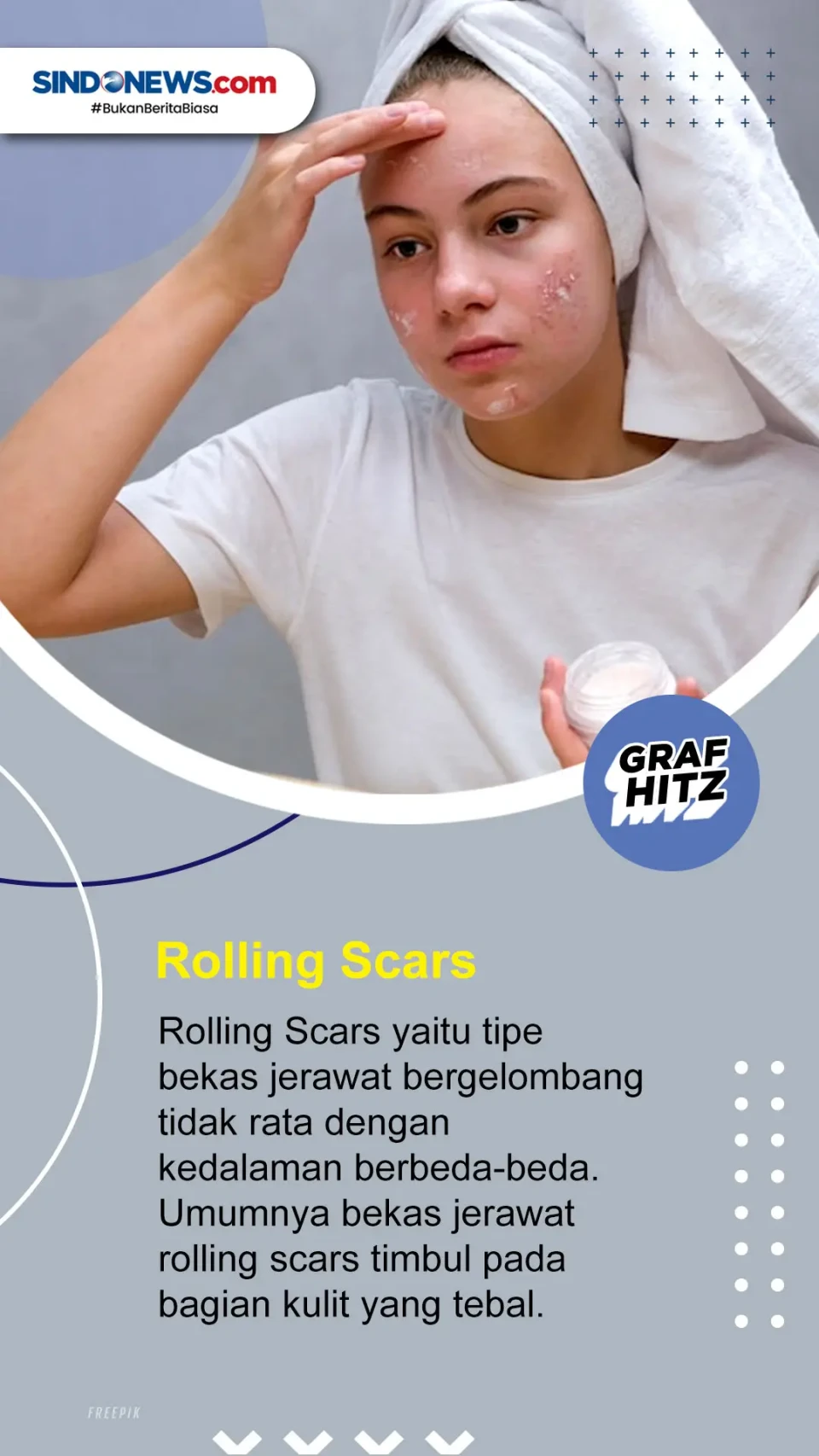 Yuk Simak! Ini 5 Jenis...