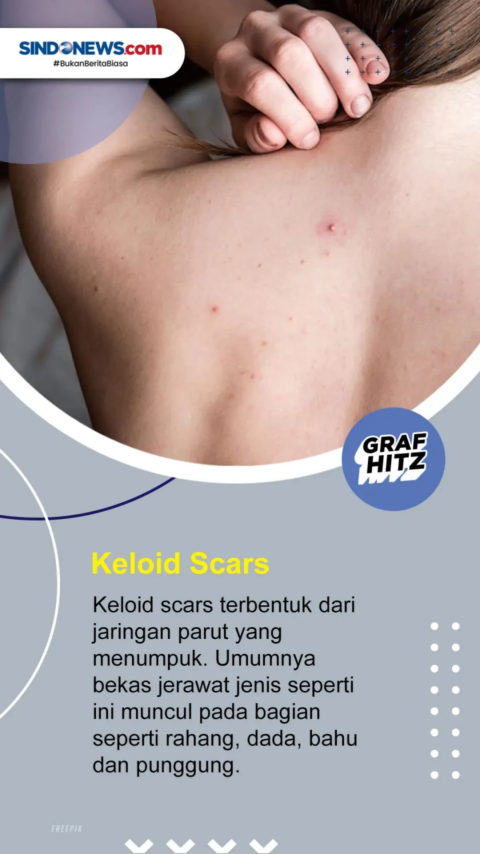 Yuk Simak! Ini 5 Jenis...