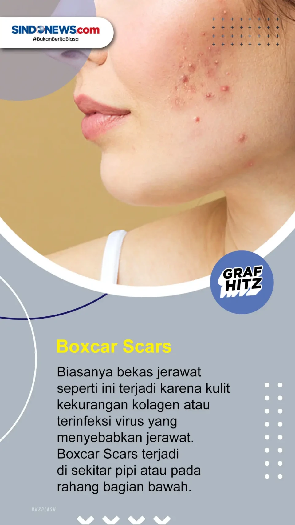 Yuk Simak! Ini 5 Jenis...